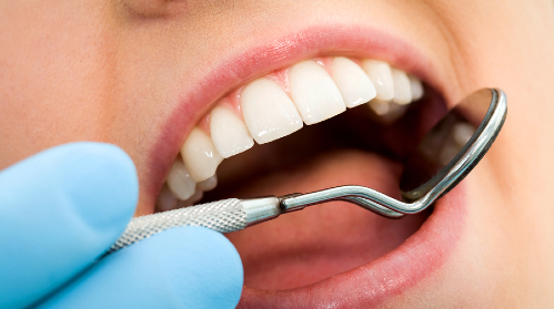 Stock photo of mouth saying 'ahhhh' fo da dentist